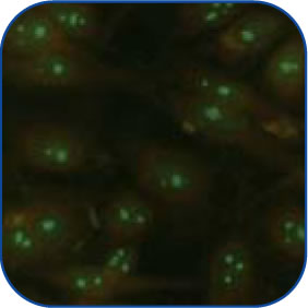 Homogeneous-Peripheral