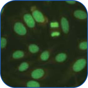 Homogeneous-Peripheral