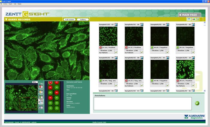 Citoplásmico/mitocondrial